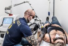 Wenn das Tribal weg soll, wird es teuer Laser Tatttoo