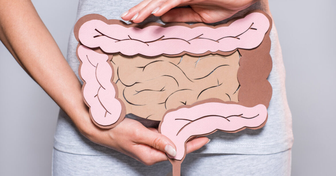 Frau hält Bild vom Darm vor ihren Bauch